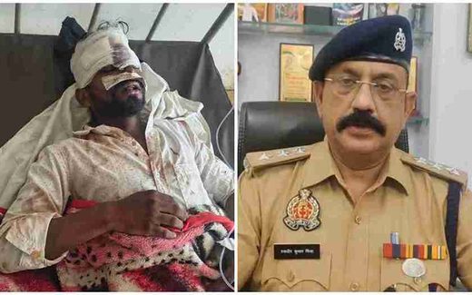 ओबरा की न्यू कॉलोनी खैरटिया में मारपीट के बाद पुलिस जांच
