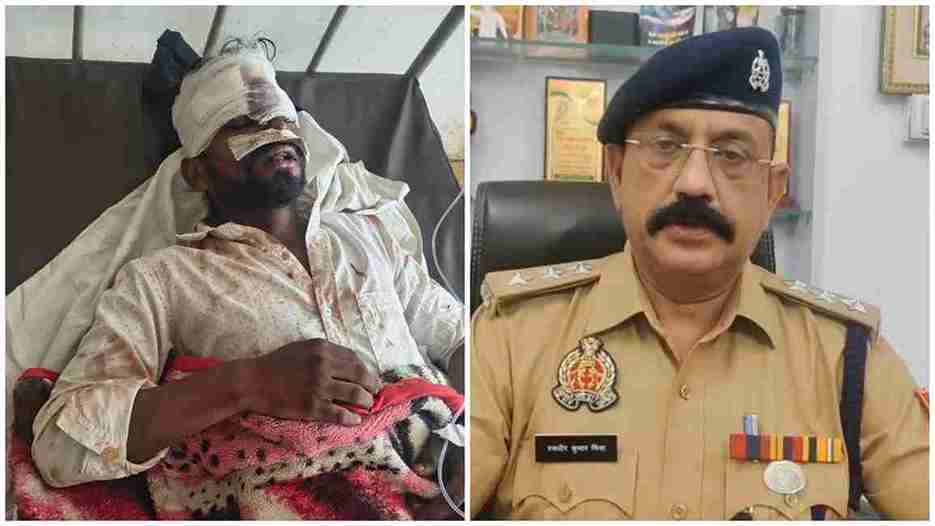 ओबरा की न्यू कॉलोनी खैरटिया में मारपीट के बाद पुलिस जांच